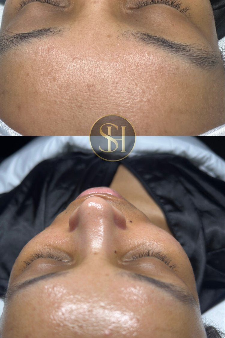 Hydrogen Crystal Collagen Mask